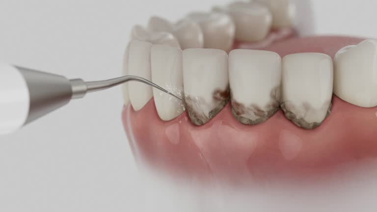 Trusted Emergency Dentist service in Iowa, LA - Dentist Open Now